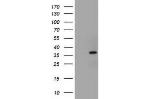 HEK293T cells were transfected with the pCMV6-ENTRY control (Left lane) or pCMV6-ENTRY ACAT2 (Right lane) cDNA for 48 hrs and lysed. (ACAT2 antibody)