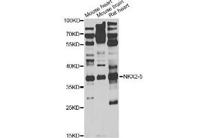 Western blot analysis of extracts of various cell lines, using NKX2-5 antibody (ABIN1876852) at 1:1000 dilution. (NK2 Homeobox 5 antibody)
