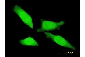 Immunofluorescence of monoclonal antibody to MTL5 on HeLa cell. (MTL5 antibody  (AA 399-508))