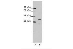 Image no. 1 for anti-Cytoplasmic Polyadenylation Element Binding Protein 2 (CPEB2) (AA 204-253) antibody (ABIN6736217) (CPEB2 antibody  (AA 204-253))