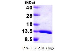 SDS-PAGE (SDS) image for Hepatoma-Derived Growth Factor (HDGF) (AA 1-100) protein (ABIN667748)