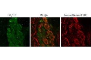 Immunohistochemistry (IHC) image for anti-Calcium Channel, Voltage-Dependent, L Type, alpha 1D Subunit (CACNA1D) (AA 859-875), (Intracellular) antibody (ABIN7043001)