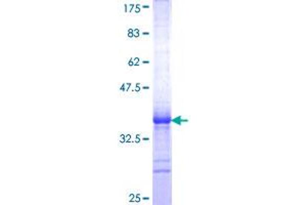 CLPS Protein (AA 23-112) (GST tag)