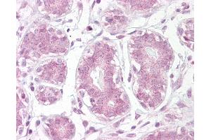Anti-IKB Alpha antibody IHC of human breast. (NFKBIA antibody  (AA 34-48))