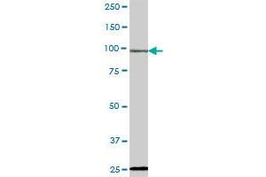 DSTYK antibody  (AA 1-587)