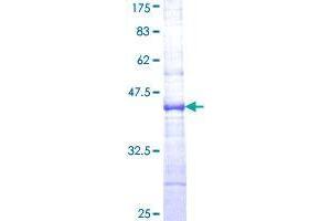 GLDN Protein (AA 131-240) (GST tag)