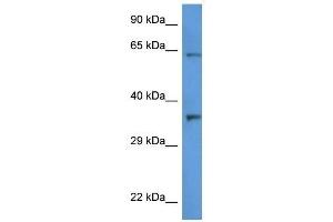Western Blot showing CTSL2 antibody used at a concentration of 1 ug/ml against HT1080 Cell Lysate (Cathepsin L2 antibody  (C-Term))