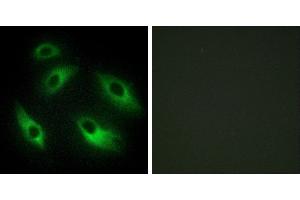 Peptide - +Immunofluorescence analysis of HeLa cells, using EPHB6 antibody. (EPH Receptor B6 antibody)