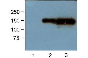 1:1000 (1 ug/ml) antibody dilution probed against HEK 293 cells transfected with GFP-tagged protein vector: untransfected control (1), 1 ug (2) and 10 ug (3) of cell lysates used.