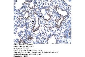 Immunohistochemistry (IHC) image for anti-Ha-Ry/enhancer-of-Split Related with YRPW Motif 1 (HEY1) (C-Term) antibody (ABIN2779686)