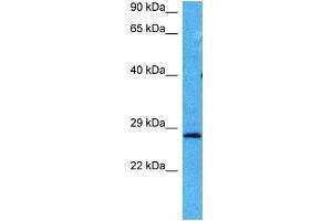 Host:  Mouse  Target Name:  HPRT1  Sample Tissue:  Mouse Testis  Antibody Dilution:  1ug/ml (HPRT1 antibody  (Middle Region))