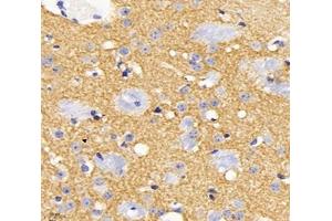 Immunohistochemistry analysis of paraffin-embedded mouse brain using,KCC2 (ABIN7075650) at dilution of 1: 1800 (KCC2 antibody)