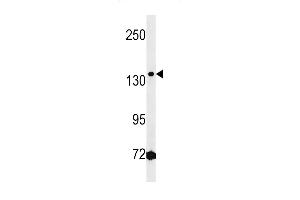 Western blot analysis of lysate from Jurkat cell line, using HMGXB3 Antibody at 1:1000 at each lane. (HMGXB3 antibody  (AA 879-908))