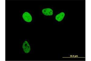 Immunofluorescence of purified MaxPab antibody to RPA1 on HeLa cell. (RPA1 antibody  (AA 1-616))