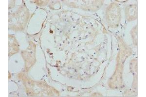Immunohistochemistry of paraffin-embedded human kidney tissue using ABIN7149277 at dilution of 1:100 (CYP4V2 antibody  (AA 246-525))
