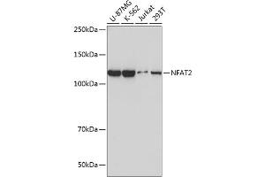 Western Blotting (WB) image for anti-Nuclear Factor of Activated T-Cells, Cytoplasmic, Calcineurin-Dependent 1 (NFATC1) antibody (ABIN7268976)