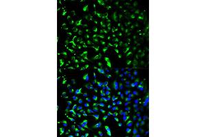 Immunofluorescence analysis of HeLa cell using PHB antibody. (Prohibitin antibody)