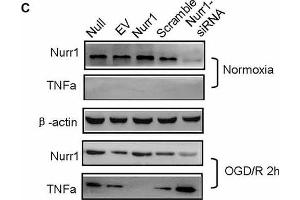 Nurr1 overexpression suppresses TNF-α expression in microglia.