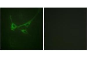 Immunofluorescence analysis of NIH-3T3 cells, using mTOR (Phospho-Ser2481) Antibody. (MTOR antibody  (pSer2481))