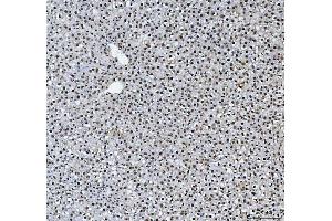 IHC analysis of HNRNPL using anti-HNRNPL antibody (ABIN4886624). (HNRNPL antibody  (C-Term))