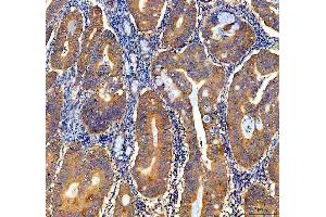 IHC analysis of NQO1 using anti-NQO1 antibody (ABIN7599200).