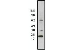 Image no. 1 for anti-SET Nuclear Oncogene (SET) antibody (ABIN793679) (SET/TAF-I antibody)