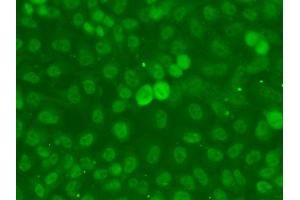 Immunofluorescence analysis of A549 cells using SSNA1 antibody. (SSNA1 antibody)