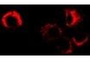 Immunofluorescent analysis of Sorbitol Dehydrogenase staining in MCF7 cells. (SORD antibody)