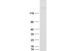 DNMT1 Protein (Transcript Variant 1) (Myc-DYKDDDDK Tag)