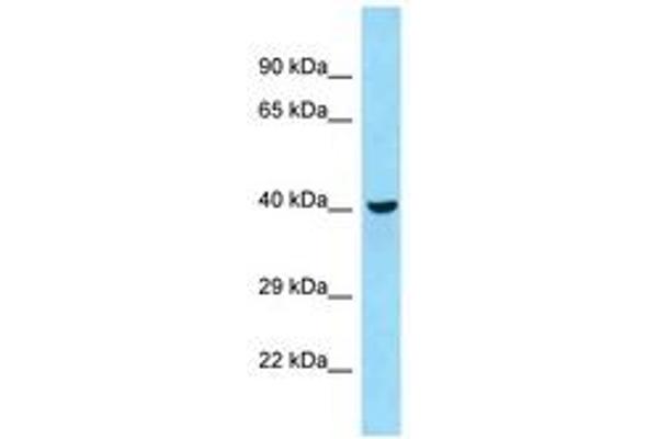 QTRTD1 antibody  (AA 189-238)
