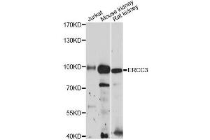 Western blot analysis of extracts of various cell lines, using ERCC3 antibody (ABIN6290288) at 1:3000 dilution.