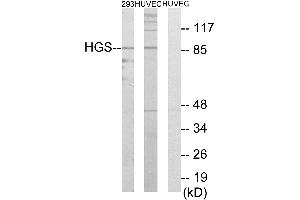 Immunohistochemistry analysis of paraffin-embedded human testis tissue using HGS antibody. (HGS antibody  (Internal Region))