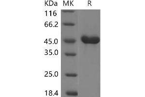 Western Blotting (WB) image for Regenerating Islet-Derived 2 (REG2) protein (Fc Tag) (ABIN7320035) (REG2 Protein (Fc Tag))