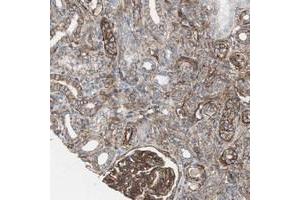 Immunohistochemical staining of human kidney with TCTA polyclonal antibody  shows cytoplasmic positivity in cells in tubules and glomeruli. (TCTA antibody)