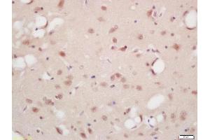 Formalin-fixed and paraffin embedded rat brain labeled with Rabbit Anti-B-Raf (Ser446) Polyclonal Antibody, Unconjugated (ABIN756787) at 1:200 followed by conjugation to the secondary antibody and DAB staining (SNRPE antibody  (pSer446))
