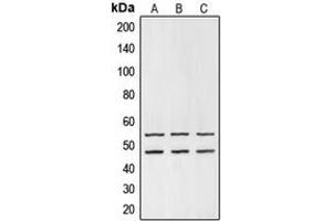 Western blot analysis of GSK3 alpha/beta expression in HEK293T (A), mouse liver (B), PC12 (C) whole cell lysates. (GSK3 alpha/beta antibody  (Center))