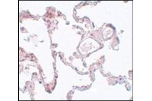 Immunohistochemistry of PLEKHM1 in human lung tissue with this product at 5 μg/ml. (PLEKHM1 antibody  (N-Term))