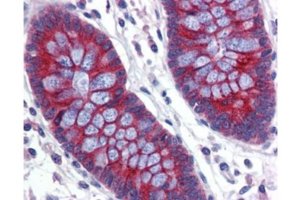 ABCA5 antibody  (C-Term)