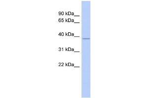 WB Suggested Anti-NEUROD4 Antibody Titration:  0. (NEUROD4 antibody  (Middle Region))