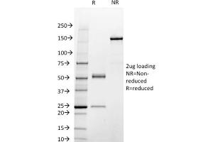 SDS-PAGE Analysis Purified STAT3 Mouse Monoclonal Antibody (STAT3/2409). (STAT3 antibody)