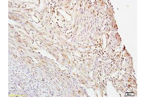 Formalin-fixed and paraffin embedded mouse uterus labeled with Anti- CTBP1 Polyclonal Antibody, Unconjugated (ABIN686152) at 1:200 followed by conjugation to the secondary antibody and DAB staining. (CTBP1 antibody  (AA 351-440))