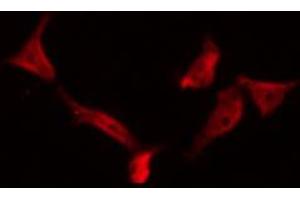 ABIN6266626 staining RAW264. (Presenilin 1 antibody  (Internal Region))