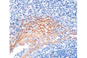 Immunohistochemistry of paraffin-embedded Human tonsil using AREG Polyclonal Antibody at dilution of 1:100 (40x lens). (Amphiregulin antibody)