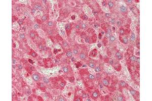 Human Liver: Formalin-Fixed, Paraffin-Embedded (FFPE).