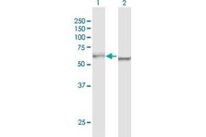 Western Blot analysis of DDX5 expression in transfected 293T cell line by DDX5 MaxPab polyclonal antibody. (DDX5 antibody  (AA 1-614))