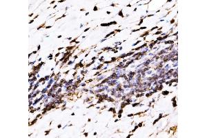 IHC analysis of EVL using anti-EVL antibody (ABIN7600986). (EVL antibody  (AA 268-400))