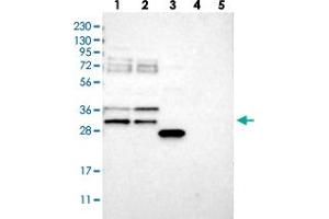 Western blot analysis of Lane 1: RT-4, Lane 2: U-251 MG, Lane 3: Human Plasma, Lane 4: Liver, Lane 5: Tonsil with RBM7 polyclonal antibody  at 1:250-1:500 dilution.