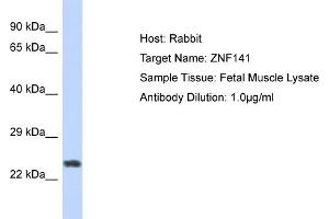 Host: Rabbit Target Name: ZNF732 Sample Tissue: Human Fetal Muscle Antibody Dilution: 1ug/ml (ZNF141 antibody  (N-Term))