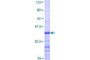K(lysine) Acetyltransferase 2B (KAT2B) (AA 731-832) protein (GST tag)