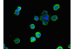 Immunofluorescent analysis of MCF-7 cells using ABIN7154080 at dilution of 1:100 and Alexa Fluor 488-congugated AffiniPure Goat Anti-Rabbit IgG(H+L) (Glutathione Reductase antibody  (AA 47-219))